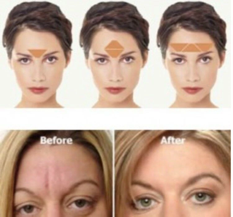 IHerb Health & Beauty FROWNIES Wrinkle Remover Facial Pads Forehead Between Eyes & Mouth 18 Patches 4 IHerb Health & Beauty FROWNIES Wrinkle Remover Facial Pads Forehead Between Eyes & Mouth 18 Patches